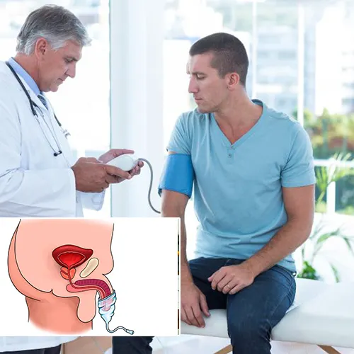 Penile Implant Surgery: What to Expect
