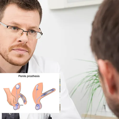 Connect with  Wauwatosa Surgery Center 
for Expert Penile Implant Care