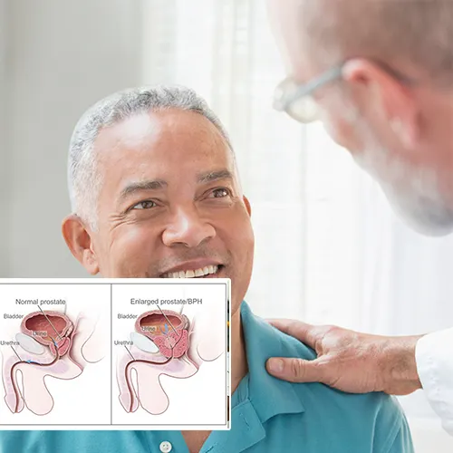 Welcome to  Wauwatosa Surgery Center 
: Your Trusted Resource for Penile Implant Insights