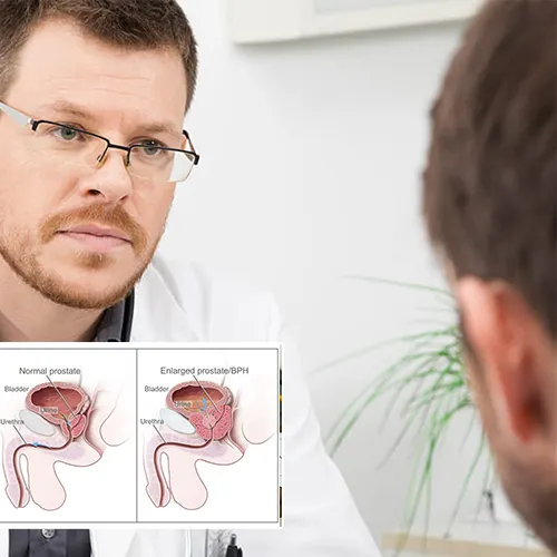 Wauwatosa Surgery Center 
: Your Trusted Partner in Men